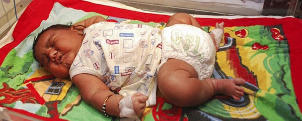 بزرگ‌ترین نوزاد تاریخ هند با وزن ۶.۷ کیلوگرم متولد شد