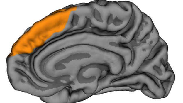 کوتاه شدن چروک‌های جلوی مغز احتمال ابتلا به اسکیزوفرنی را افزایش می‌دهد
